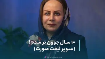 فیلم عمل لیفت صورت مجموعه زیبایی دنیز